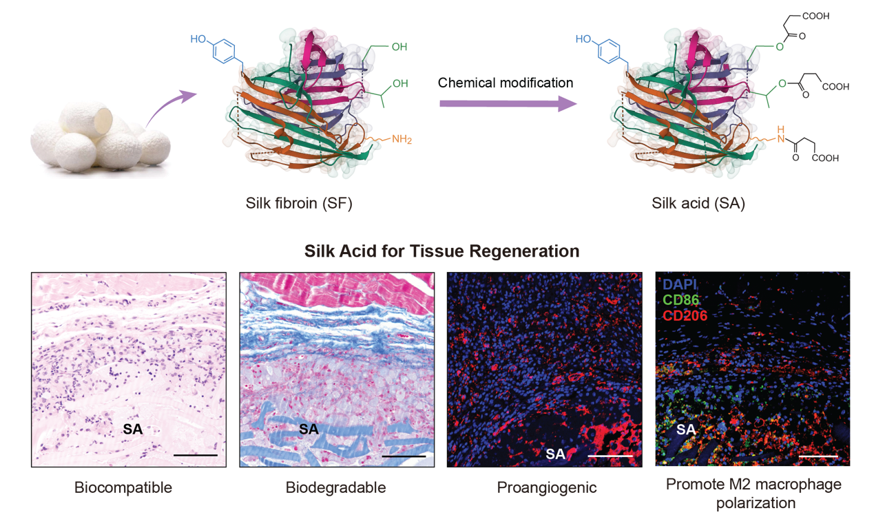 Silk Acid: A new kind of biomaterial for tissue regeneration developed ...